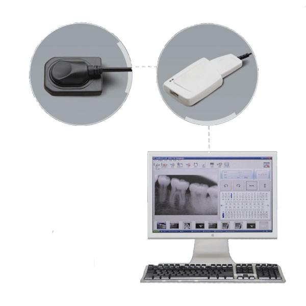 Digital Intraoral X-Ray Imaging System