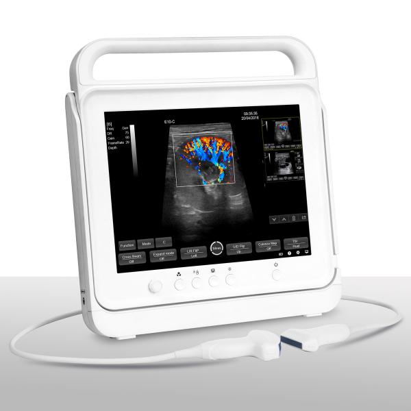 Touch Color Doppler Ultrasound Scanner System
