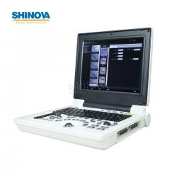 Full Digital Ultrasound with PW